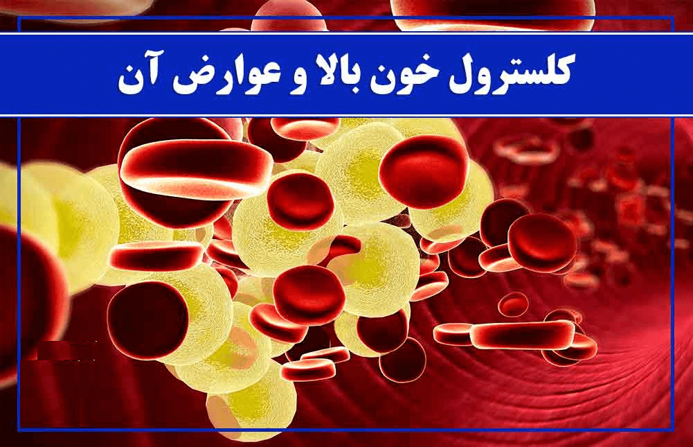 کلسترول خون بالا